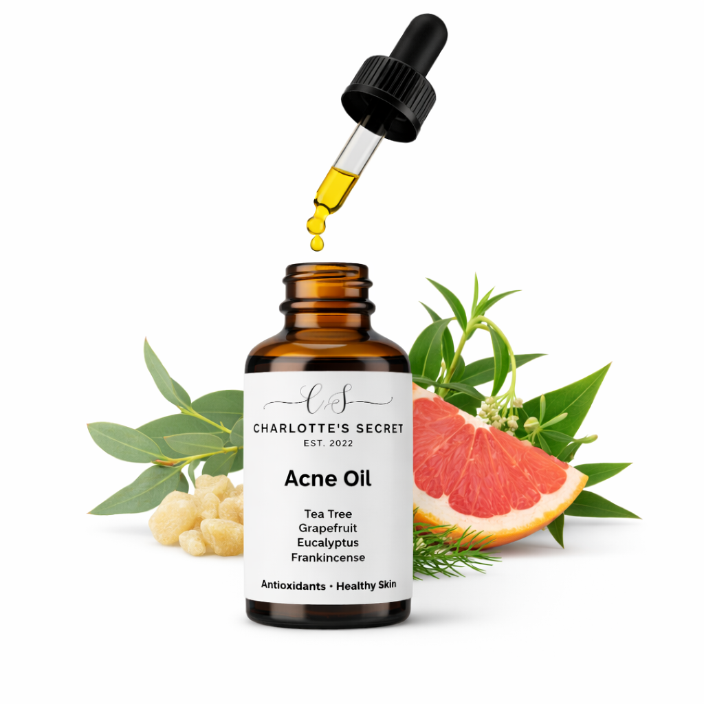 Natural Acne Treatment Oil for Clear Skin 30ml